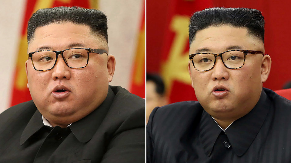 Zabrinutost i spekulacije zbog mršavljenja Kim Jong Una