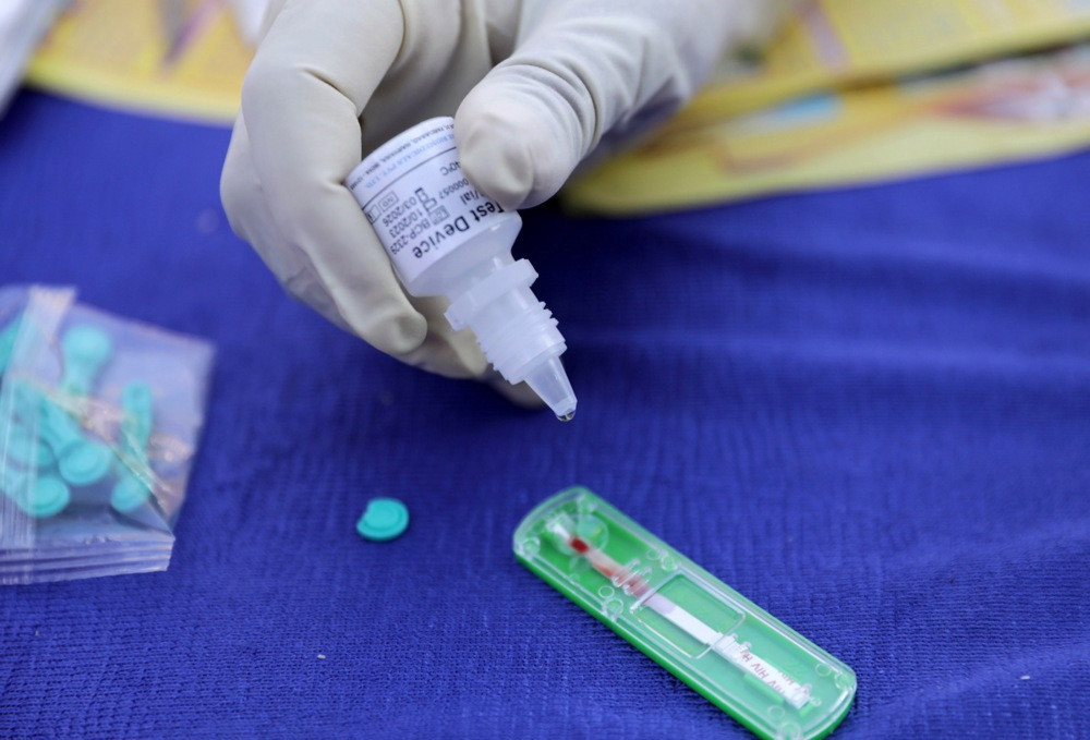 U ovoj godini u FBiH registrovano 26 novootkrivenih slučajeva HIV-a