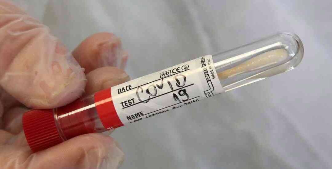 Od ponedjeljka u RS-u jeftiniji komercijalni testovi na virus korona