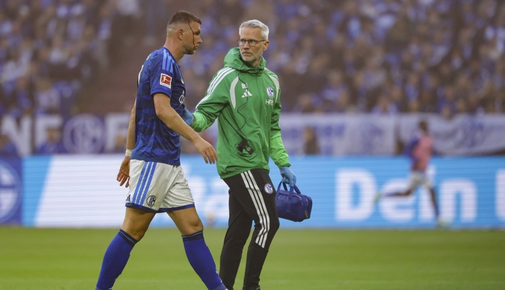 Oglasio se Schalke: Džeko zadobio duboku posjekotinu na glavi