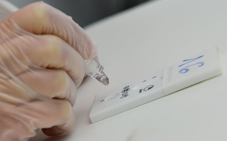 KS: 87 novozaraženih, 133 oporavljene osobe