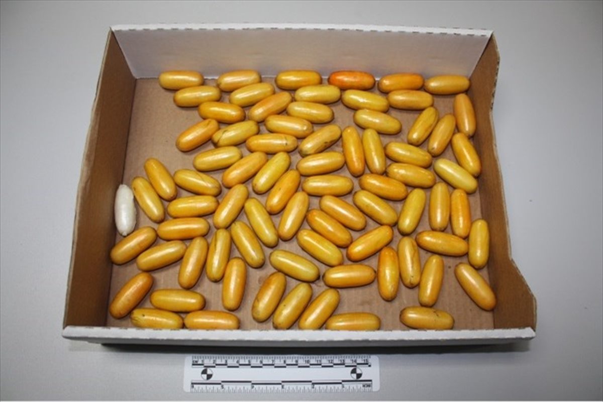 Hrvatska: Brazilka u tijelu pokušala prošvercati 990 grama kokaina