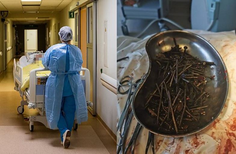 Kilogram eksera izvađen iz stomaka pacijenta u Litvaniji