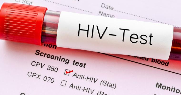 U Nigeriji dosad od posljedica zaraze virusom HIV preminulo 1,6 miliona ljudi