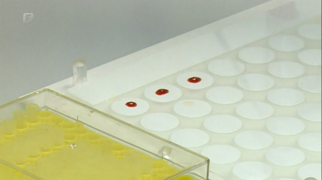 INZ Zenica i Agencija za sigurnost hrane BiH radit će na jačanju koncepta Jedno zdravlje