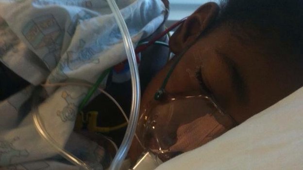 Britanski patolog prvi put u povijesti potvrdio onečišćenje zraka kao uzrok smrti