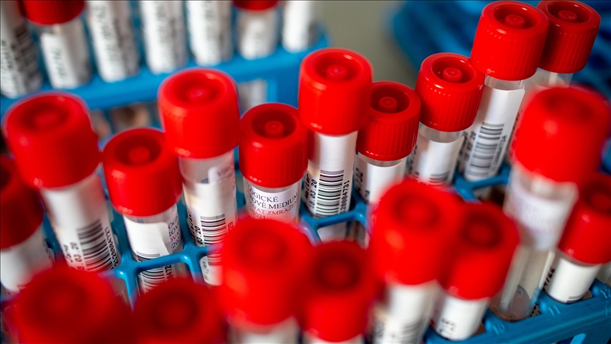 U RS-u 423 novozaraženih, preminula 21 osoba