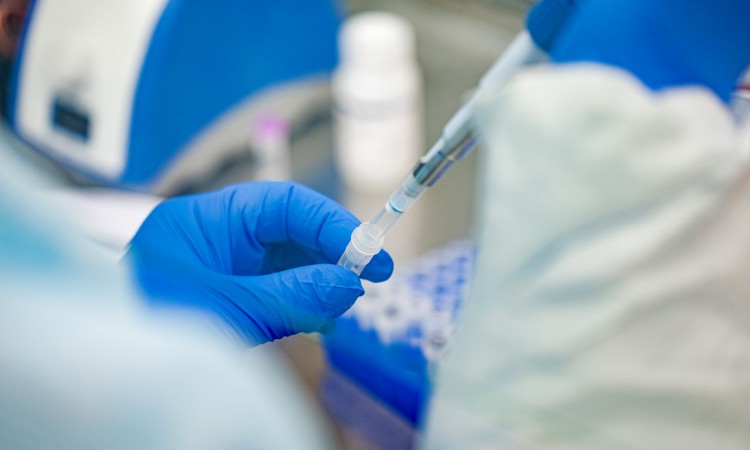 U RS virus korona potvrđen kod 349 osoba, osam smrtnih slučajeva