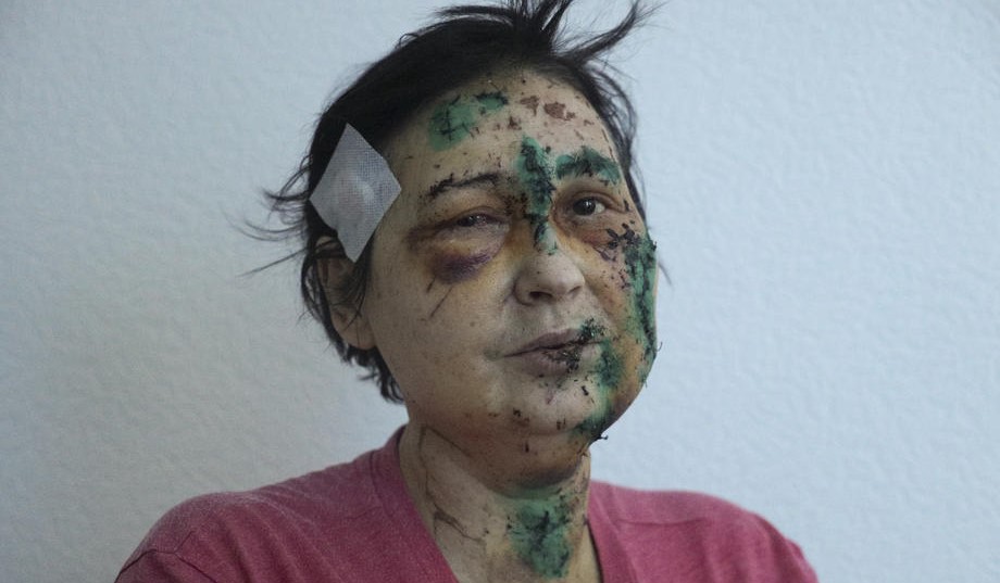 U Ukrajini poginula najmanje 474 civila, strahuje se da je broj mnogo veći