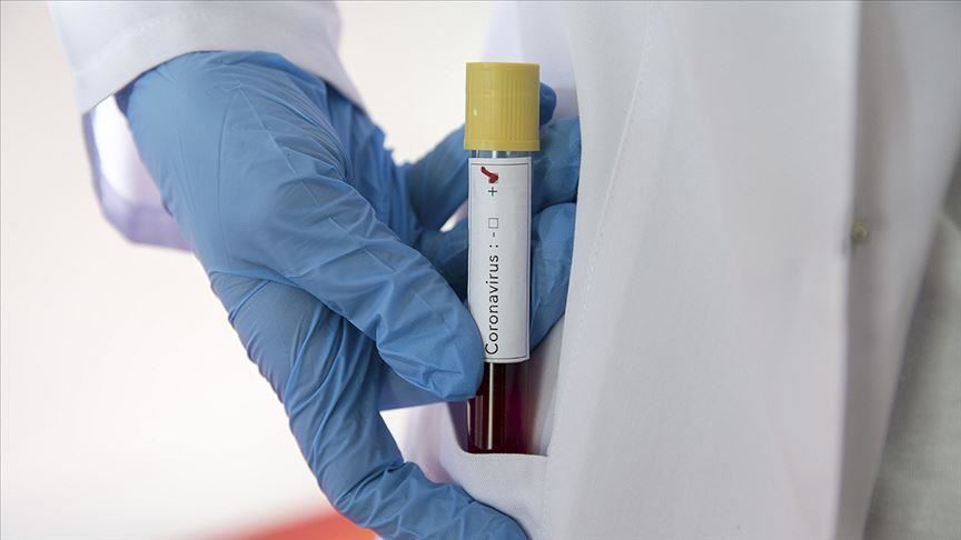 U Sloveniji od danas nove mjere, visok postotak pozitivnih testova