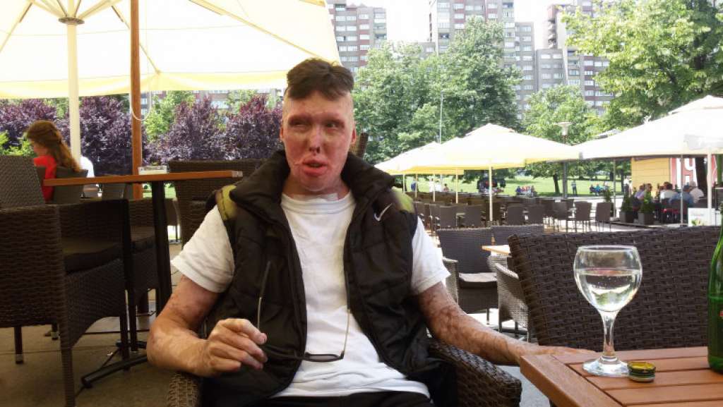 Pomozi.ba - Aldin Jacić ponovo mora na operativni zahvat