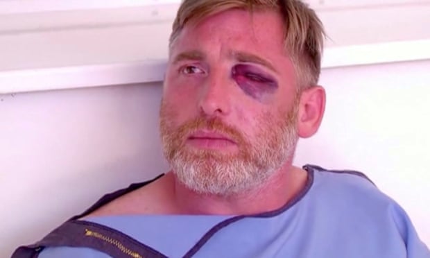 Preminuo gruzijski snimatelj kojeg su pretukli anti-LGBTQ demonstranti