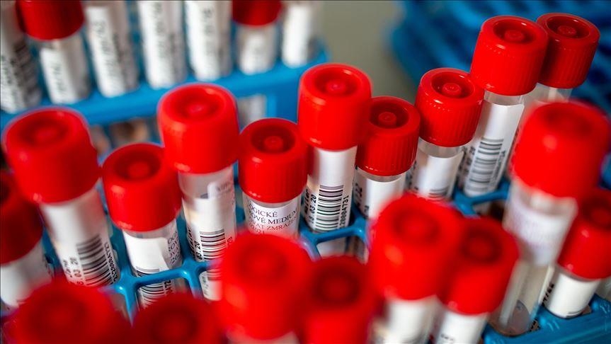 U BiH 247 novozaraženih koronavirusom, preminulo 13 osoba