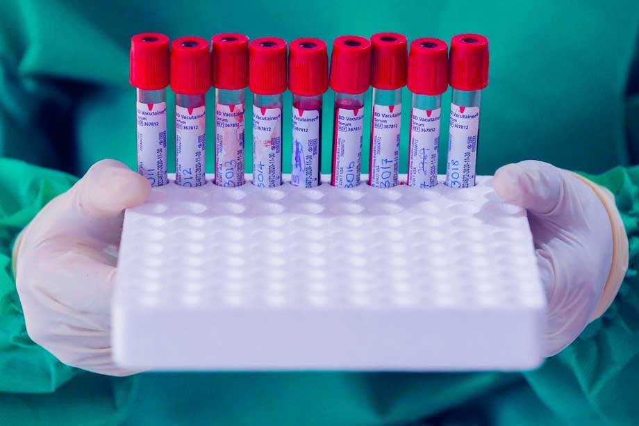 U RS-u virus korona potvrđen kod 294 osobe, preminulo 13 osoba