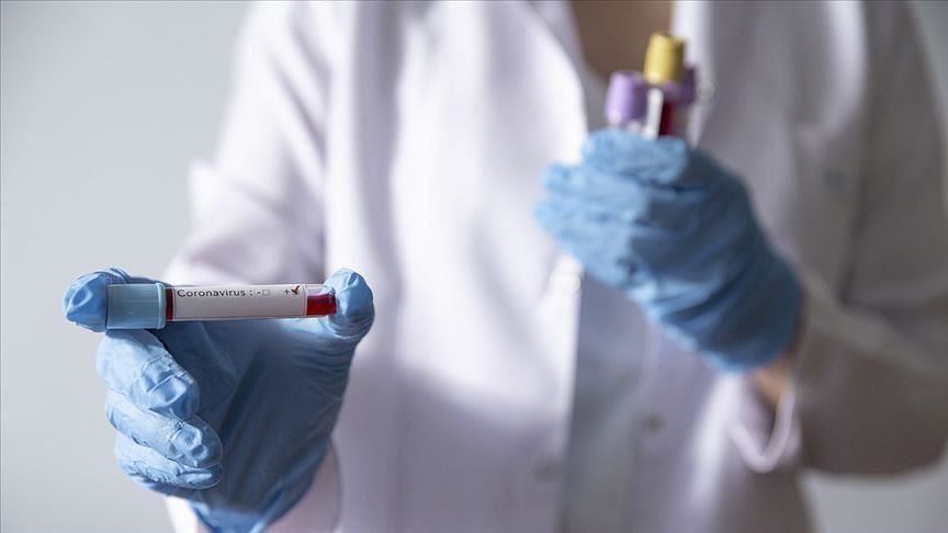 Virus korona potvrđen kod 333 osobe u RS-u, 12 osoba preminulo