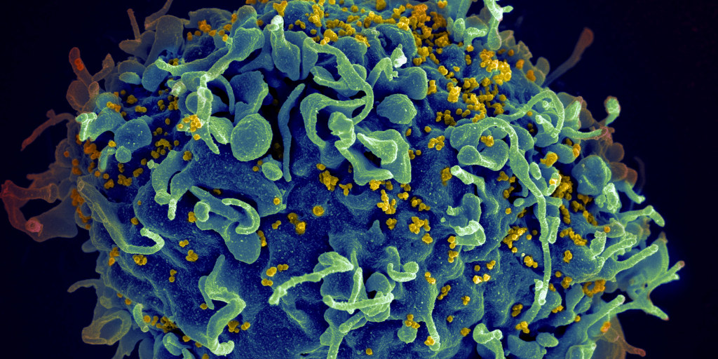 Prva žena izliječena od HIV-a nakon transplantacije matičnih ćelija