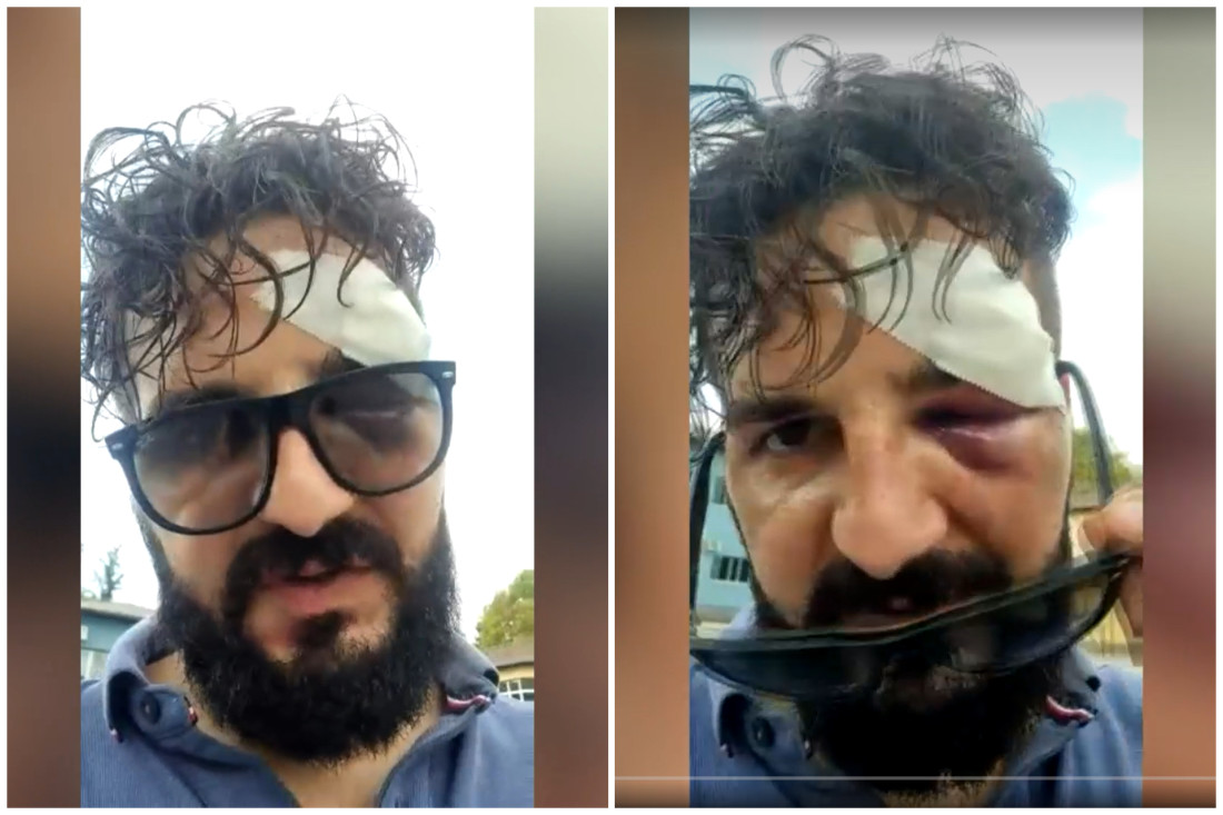 Kolegij Vlade Brčkog osudio napad na novinara Mirzu Derviševića