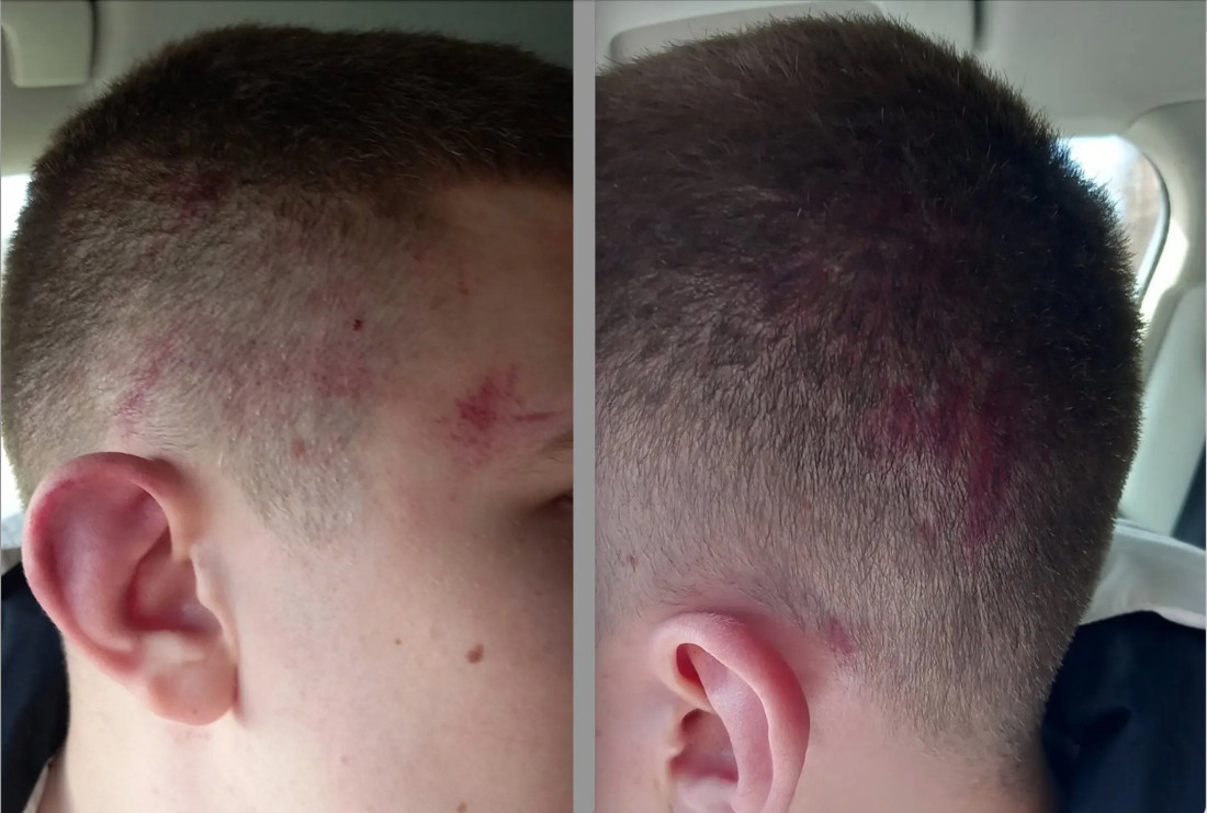 Kosovska policija u o incidentu u kojem je pretučen maloljetni Srbin