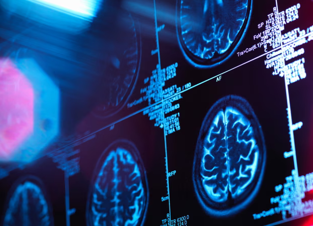 Život u fazama: Mozak prolazi kroz pet ključnih epoha od djetinjstva do starosti