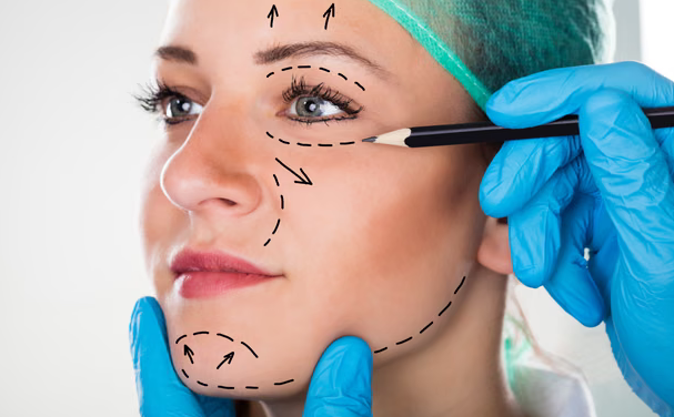 Facelift u 30-ima: Zašto sve više mladih žena bira invazivnu estetsku operaciju