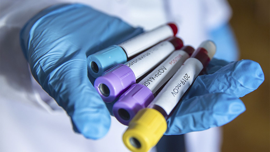 U Srbiji registrovana 202 nova slučaja zaraze koronavirusom