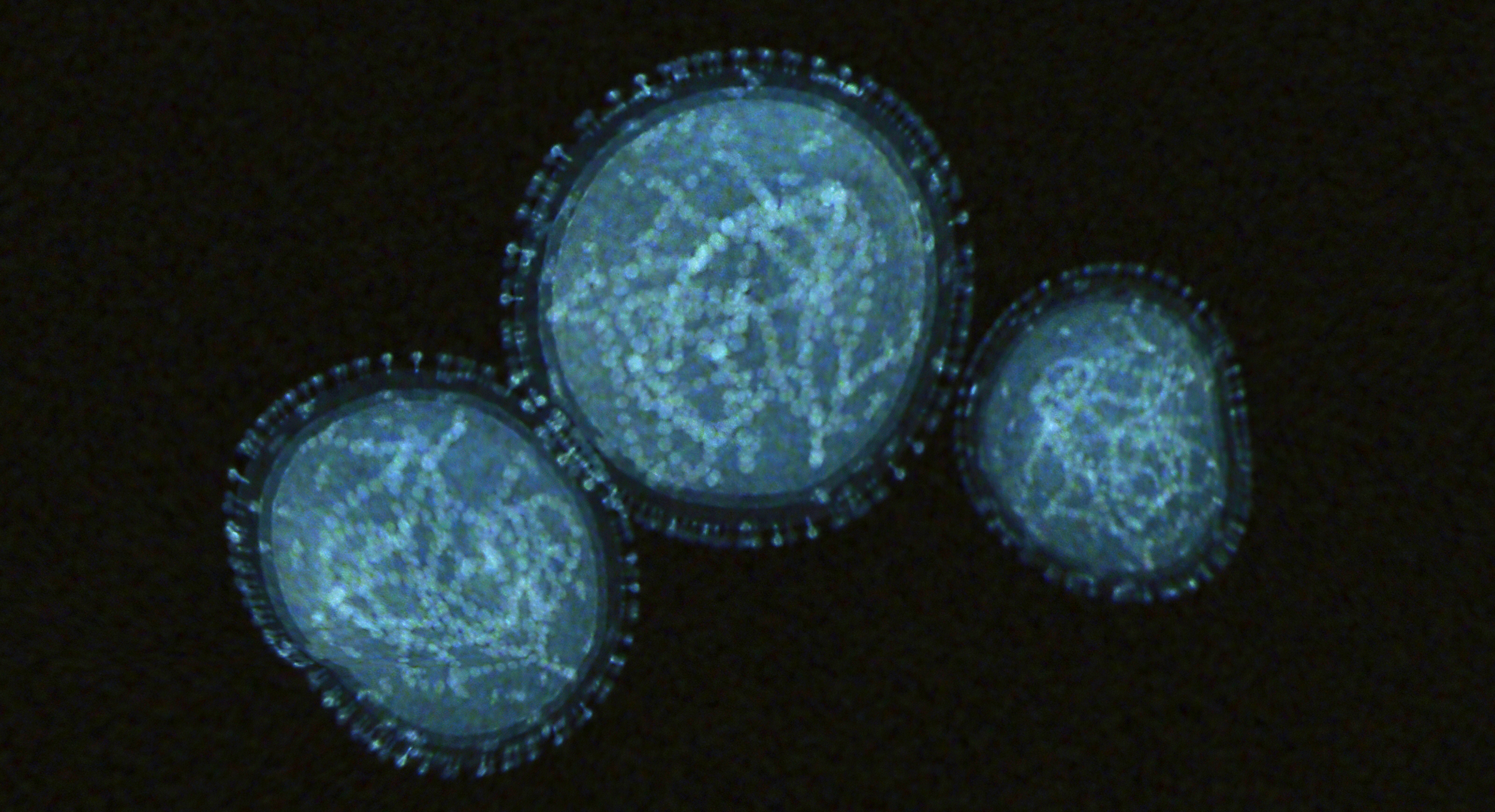 SAD hoće da vakcinišu kontakte osoba oboljelih od majmunskih boginja