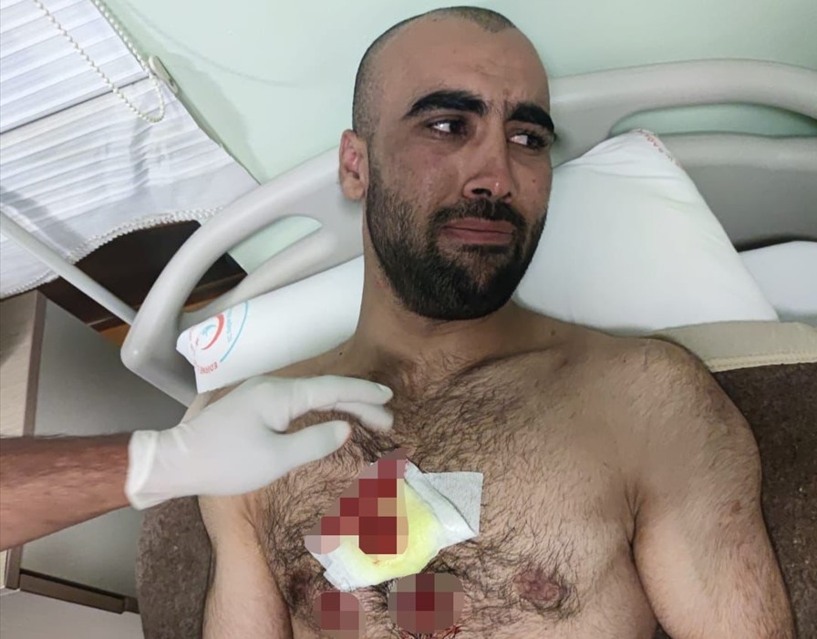 Grčka koristila gumene metke protiv migranata