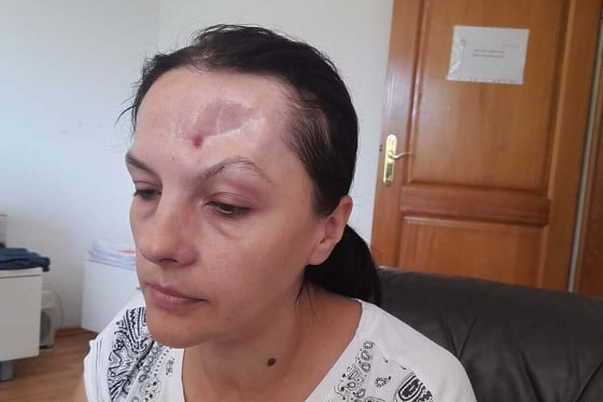 Udruženje Pomozi.ba pokrenulo apel za liječenje Zlate Pivić iz Bihaća