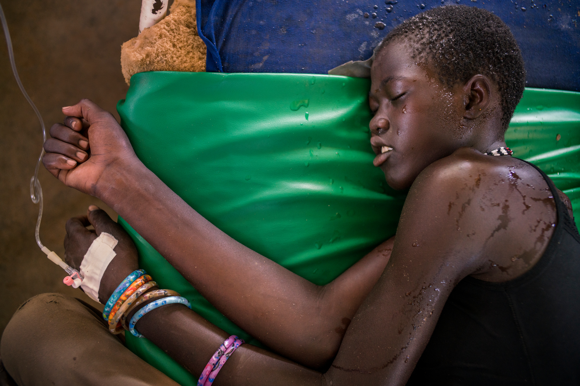 U Južnom Sudanu povećanje broja slučajeva malarije i upale pluća