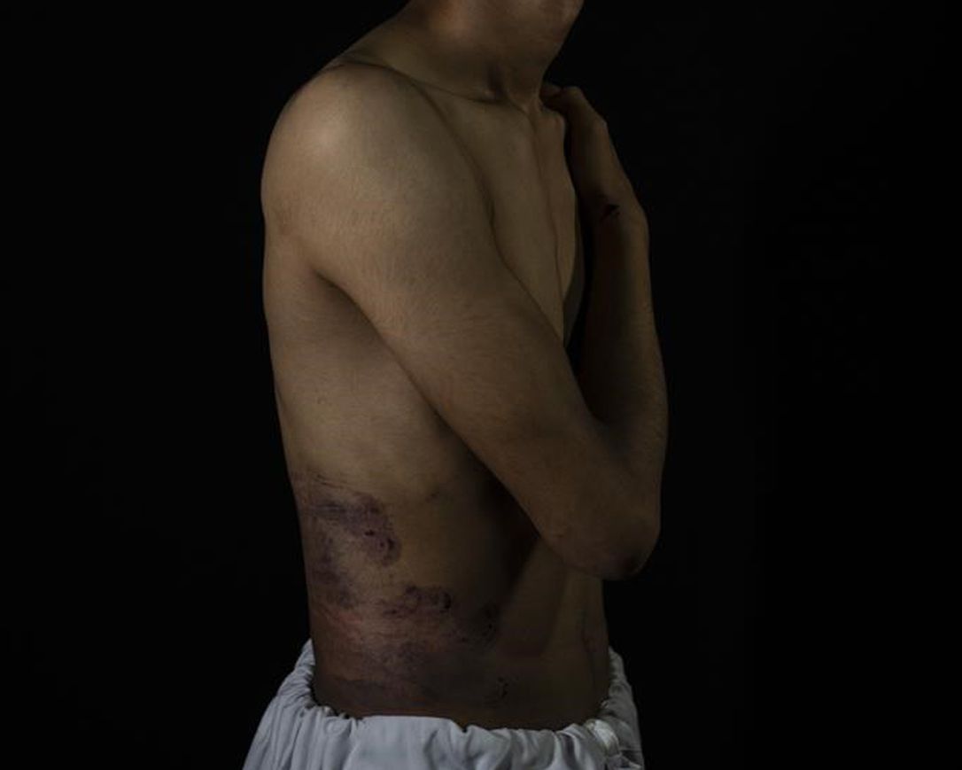 Nasilje nad novinarima u Afganistanu