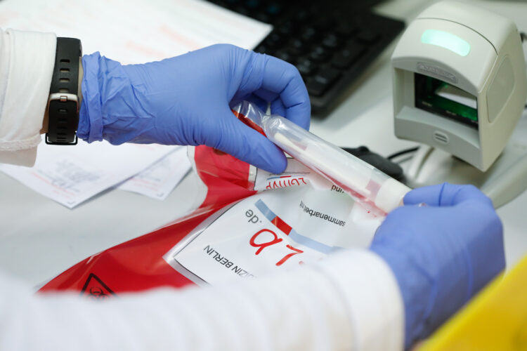 Na virus korona u RS pozitivno još 59 osoba, četiri smrtna slučaja