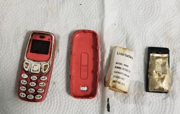 U Prištini pacijentu izvadili telefon iz stomaka