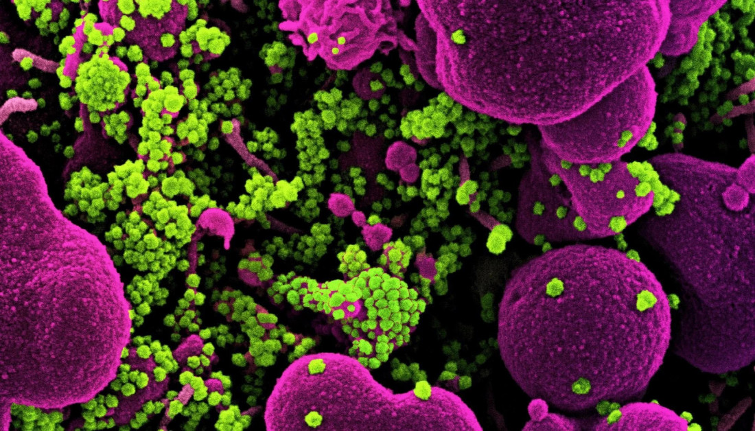 Novi talasi zaraza novim varijantama omikron soja koronavirusa