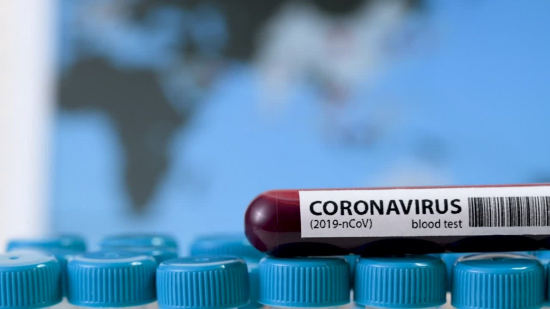 U BiH 393 novozaraženih koronavirusom, od kojih 51 u Brčkom, četiri osobe preminule
