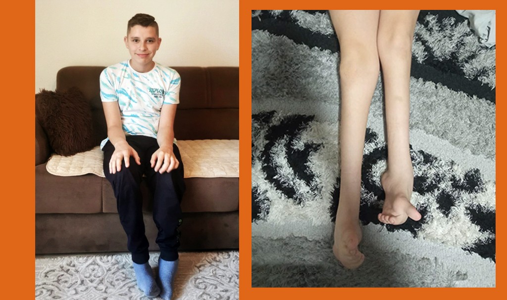 Udruženje Pomozi.ba pokrenulo apel za 12-godišnjeg Sanjina iz Busovače