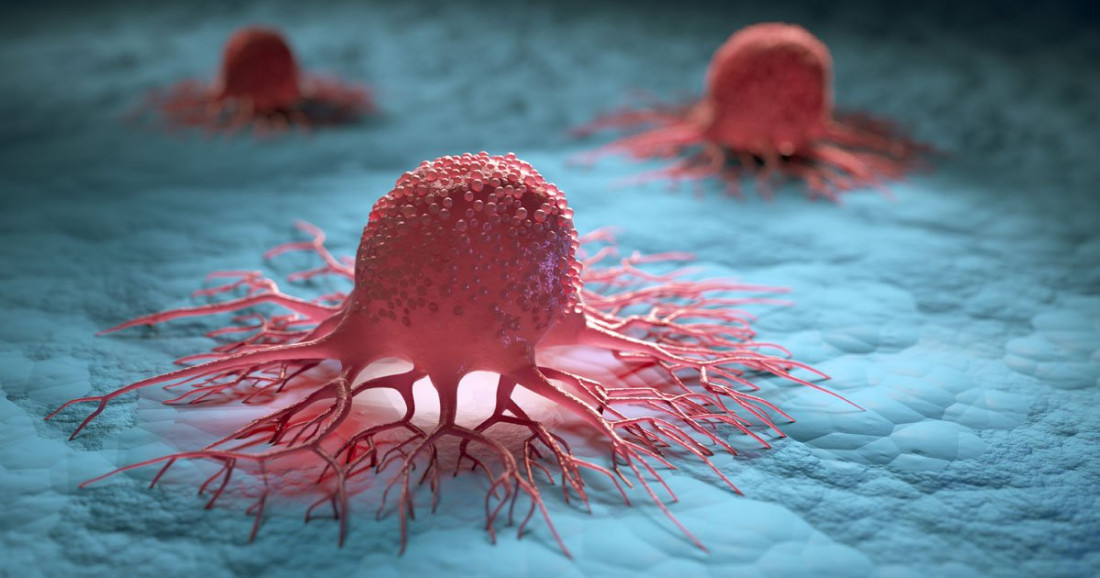 Novi lijek protiv tumora rektuma stopostotono liječi pacijenete