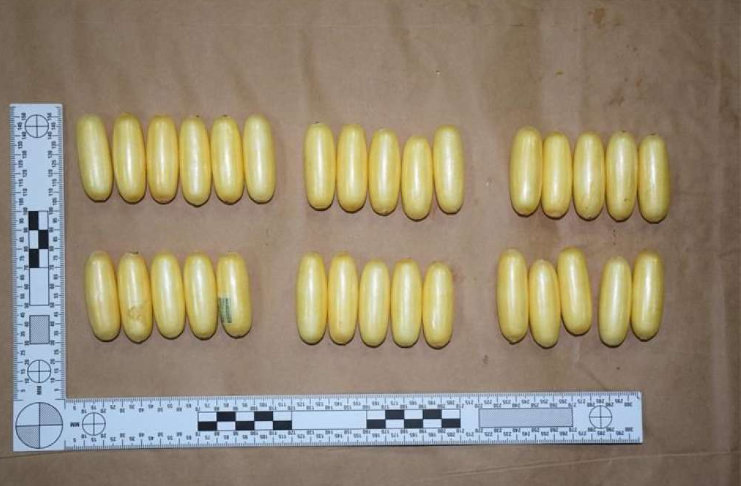 Brazilac progutao 117 kapsula ispunjenih drogom