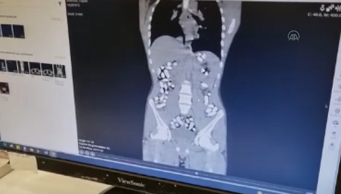 U tijelima petorice Iranaca pronađeno sedam kilograma droge