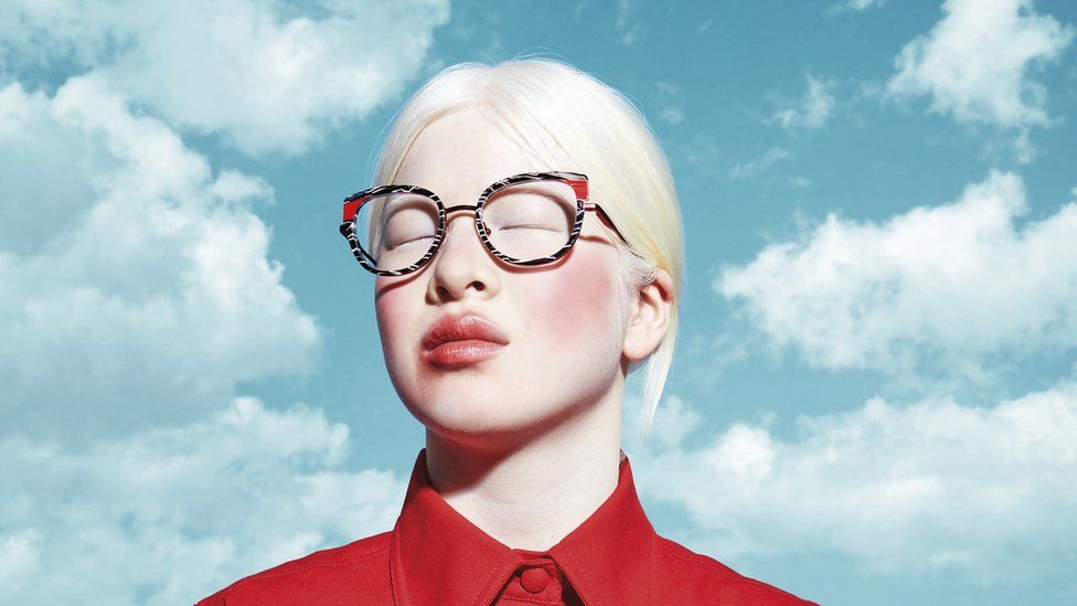 Od sirotišta do „Voguea“: Kako je djevojka sa albinizmom postala model