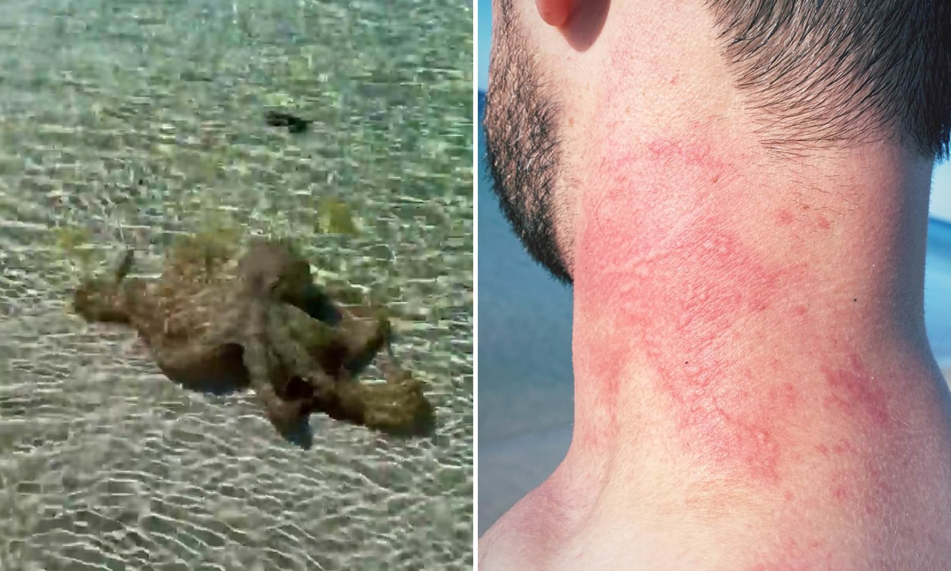 Geologa na plaži napala "ljutita hobotnica"