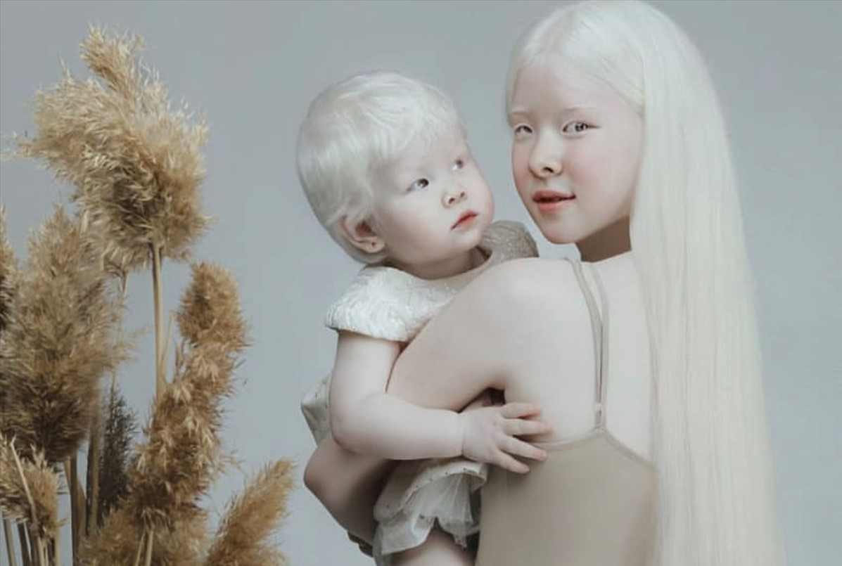 Kazahstan: Albino sestre, poznate kao "bijele princeze", u fokusu modnog svijeta