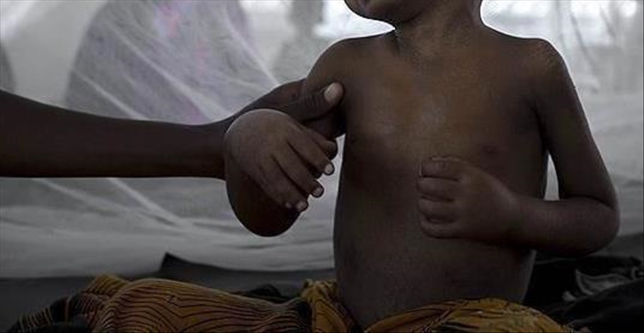 Prvu vakcinu protiv malarije u svijetu primilo više od 650.000 djece u Africi