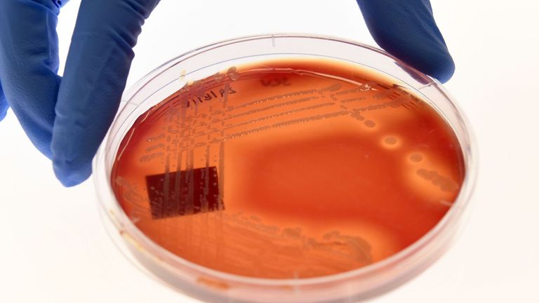 Sveučilište u Oxfordu otvara institut za istraživanje otpornosti na antibiotike