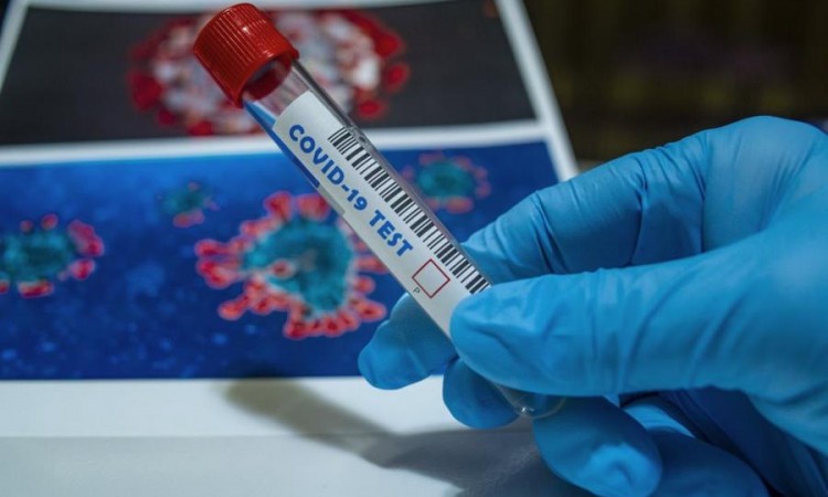 U Srbiji preminulo 30 osoba, 1.987 novozaraženih koronavirusom