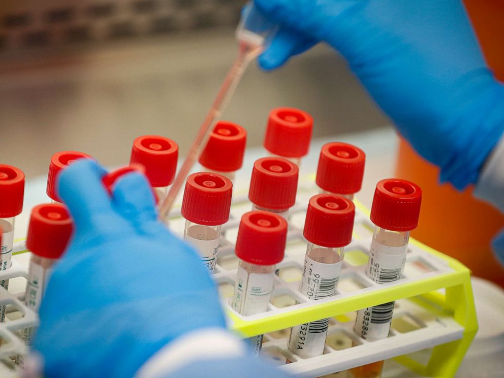 Četiri smrtna i 56 novih slučajeva zaraze koronavirusom u TK