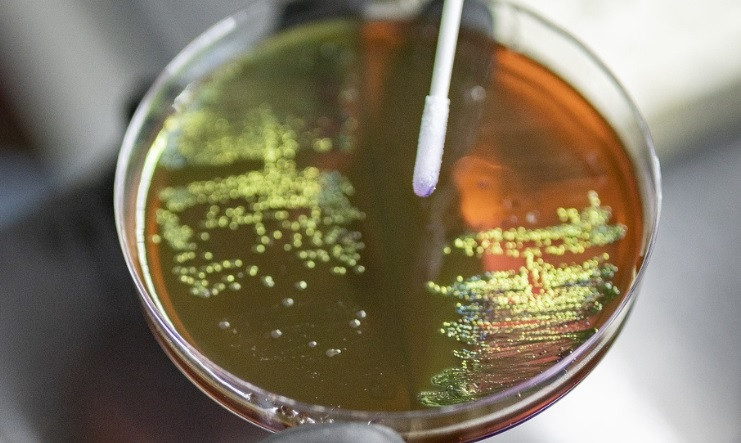 WHO upozorava na alarmantni porast otpornosti na antibiotike