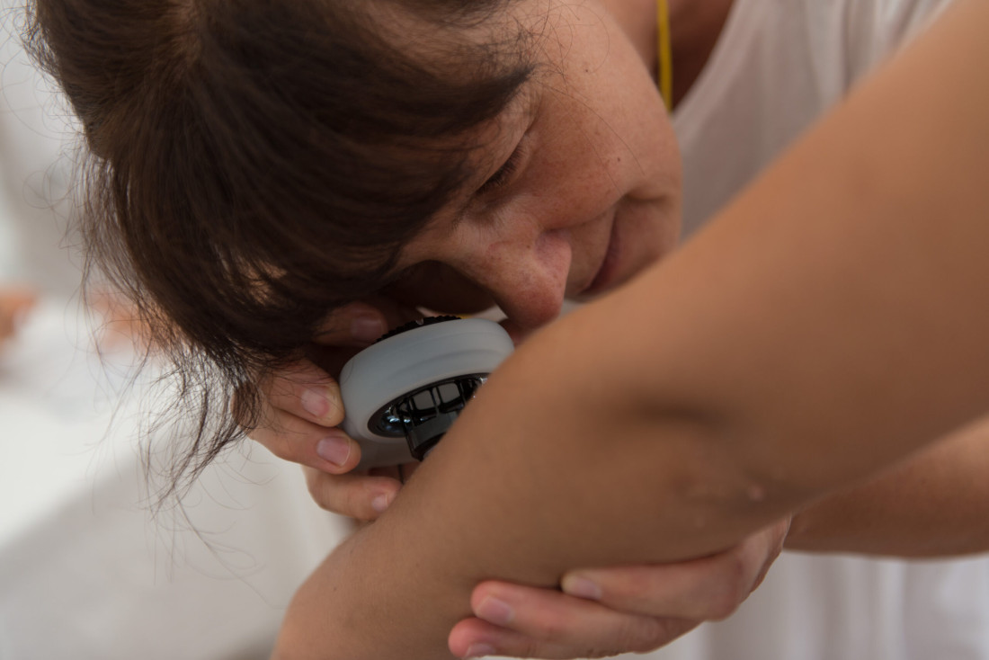 Ovog vikenda u Sarajevu i Zenici besplatni dermatološki pregledi