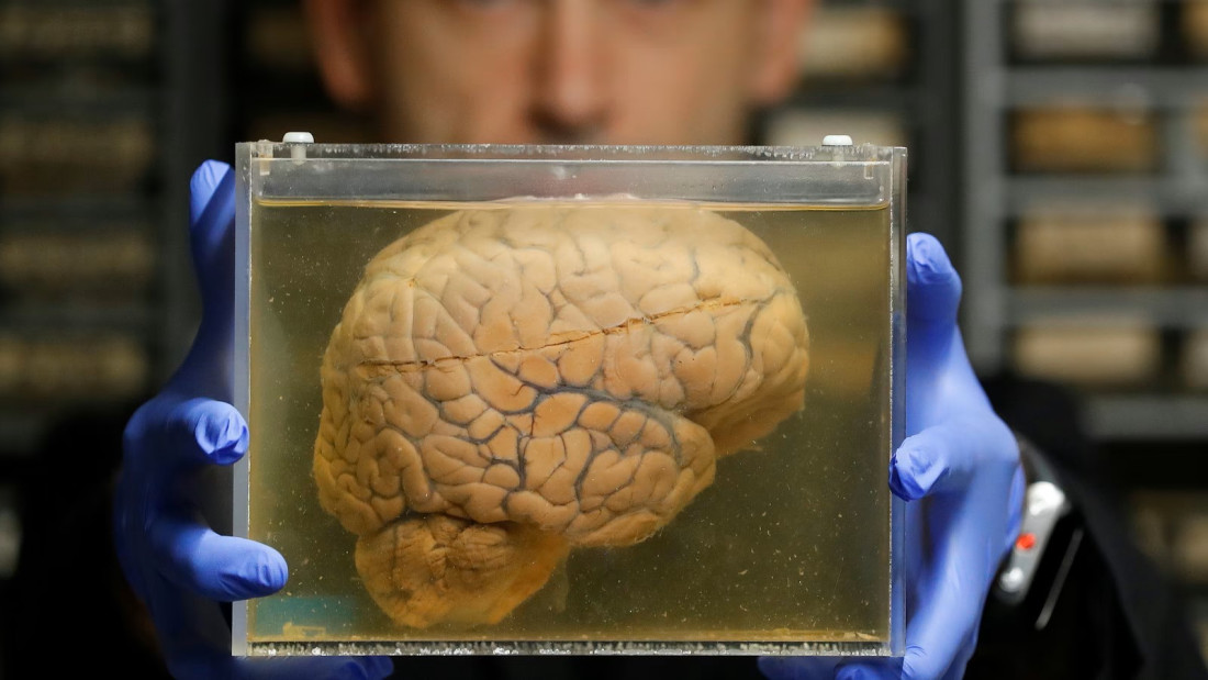 Novi detalji u Epsteinovoj aferi - Otvorena istraga o navodnom slanju uzoraka mozgova iz Sjeverne Makedonije u SAD