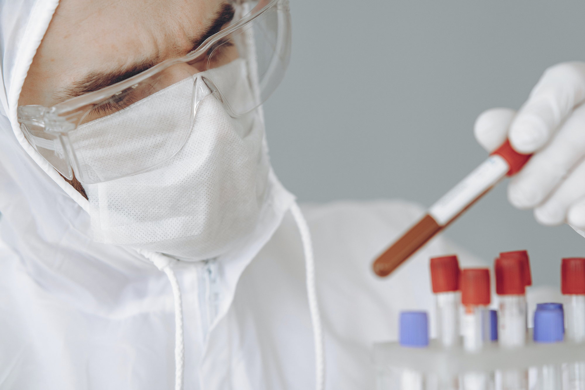 384 nova slučaja zaraze koronavirusom u protekla 24 sata u KS-u