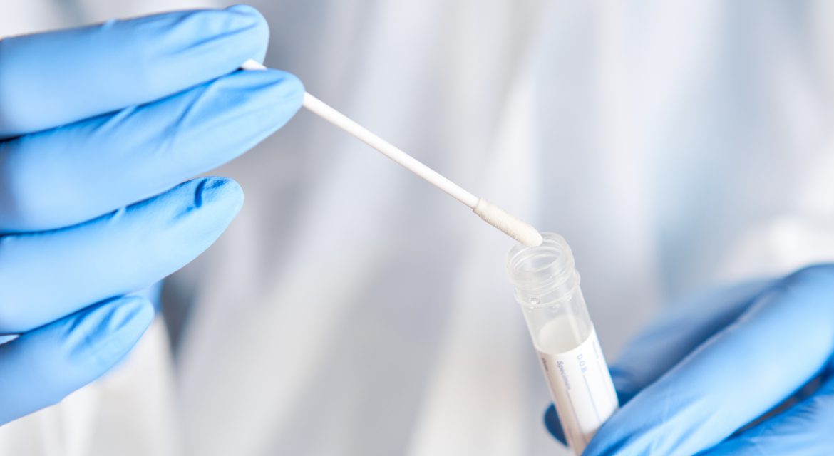 Soj omikron u Madridu